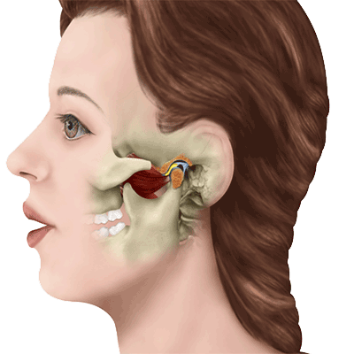 moving graphic of woman showing jaw interior movement, Pueblo CO TMJ treatment